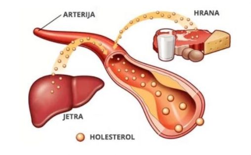 viri holesterola